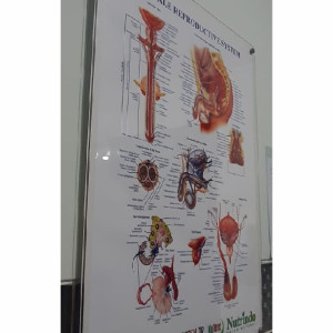 AKRILIK BENING 3MM + PEN AKRILIK + JASA PASANG