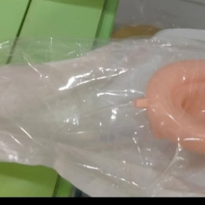 MASKER LARING - LARYNGEAL MASK AIRWAY - LOH JINAWIE