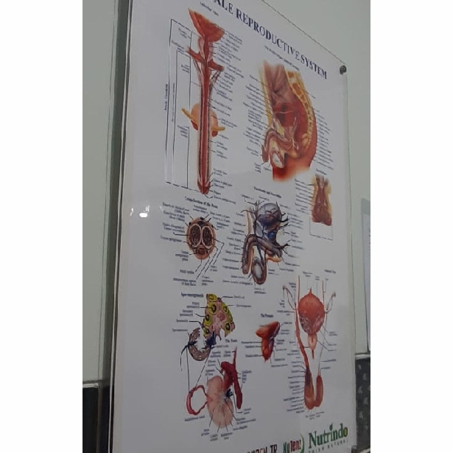 AKRILIK BENING 3MM + PEN AKRILIK + JASA PASANG - samping